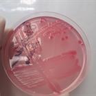 Výstavka bakterií