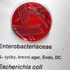 Výstavka bakterií
